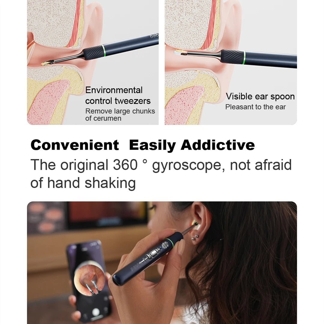 Smart Visual Ear Sticks Endoscope Tweezers High Precision Earpick Mini Camera Otoscope Health Care Ear Cleaner